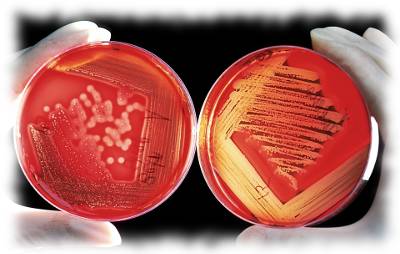 Bild der Bakterie Lactobacillus rhamnosus